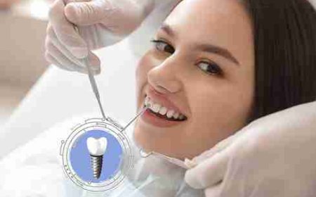 Instant Fix for Cracked Teeth Through Dental Implantation