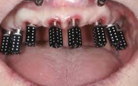 How To Fix Common Errors During Icam Photogrammetry Capture