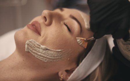 Can Green Peel Reduce Acne Breakouts?