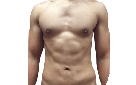 What Makes Vaser 4D Liposuction a Top Body Sculpting Choice