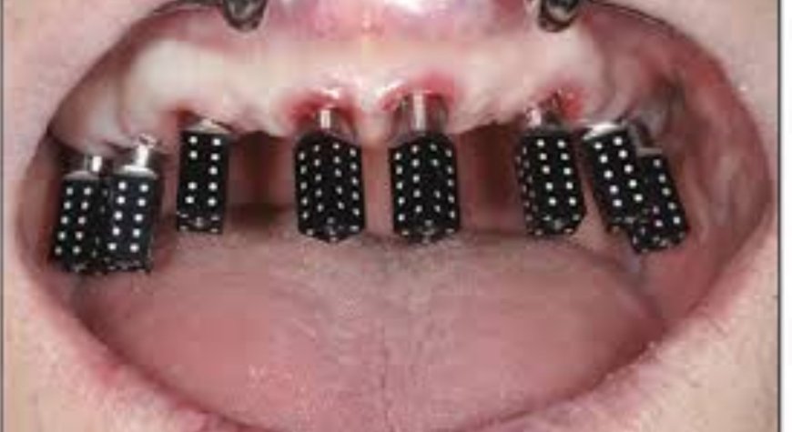 How To Fix Common Errors During Icam Photogrammetry Capture