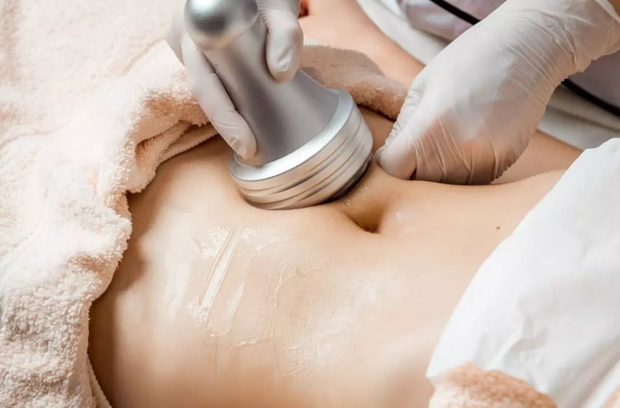 Can Laser Lipolysis improve overall physique?