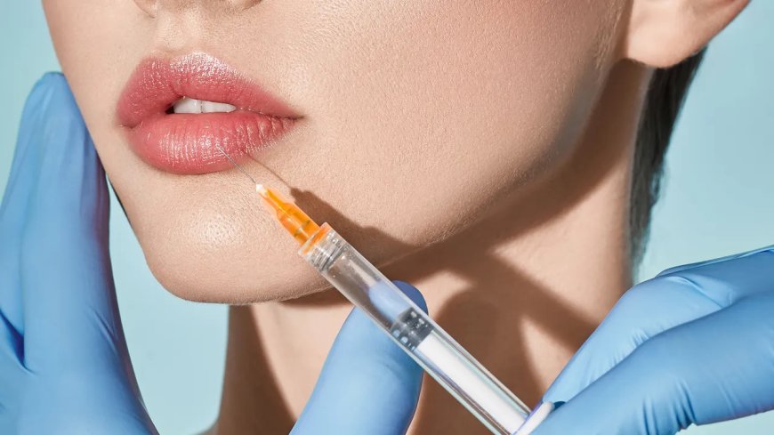 Unlock Fuller Lips Safely with Best Lip Fillers Injections