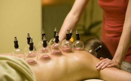 Can Hijama Help With Migraines and Headaches?