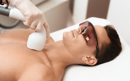 Best Laser Hair Removal for a Cleaner Look Without Daily Shaving
