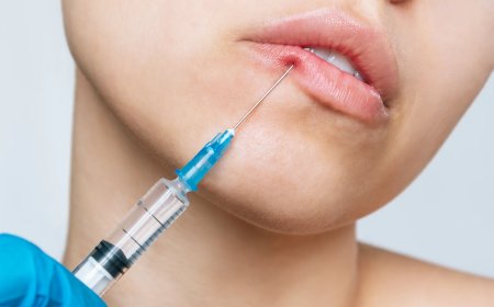 How Best Lip Fillers Injections Give You a Soft Glamorous Look