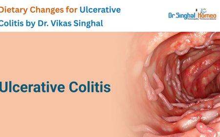 Managing Ulcerative Colitis: Simple Dietary Changes for Symptom Relief