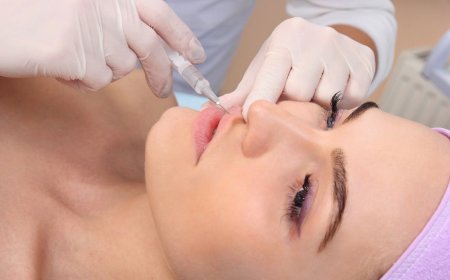 Best Lip Fillers Injections That Give You a Youthful Look Fast