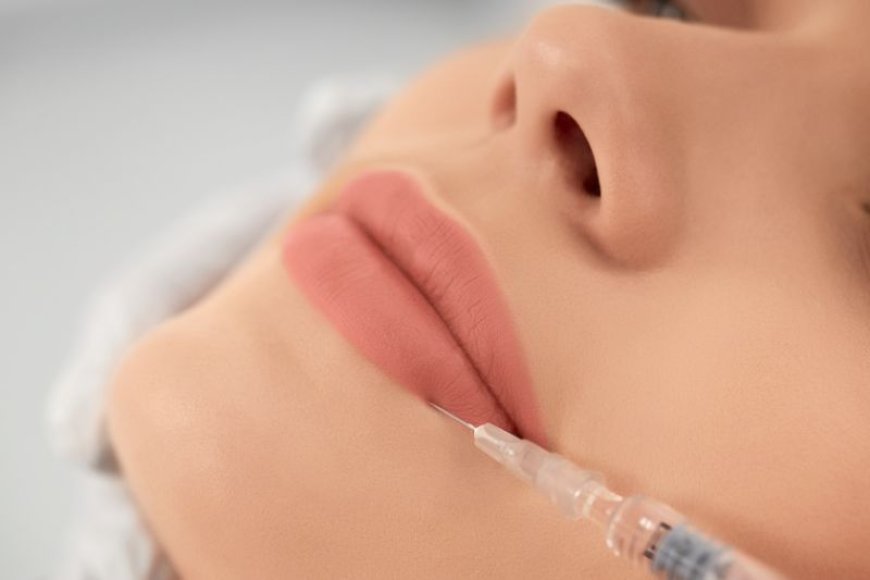 What to Expect from the Best Lip Fillers Injections Experience