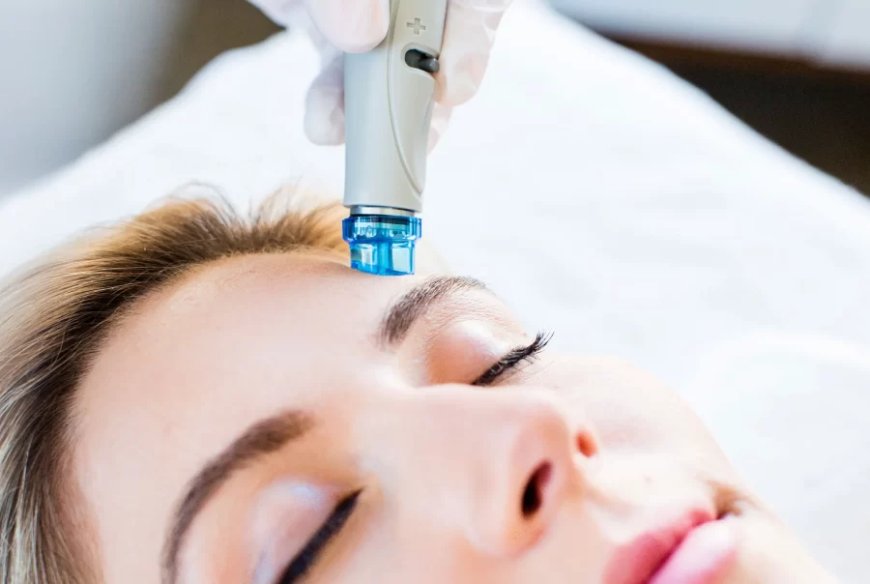 Discover the Fastest Way to Refresh Your Face With Hydrafacial