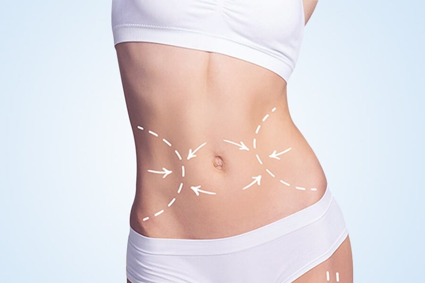 Fast Tummy Tuck Results That Make You Feel Fit and Fabulous