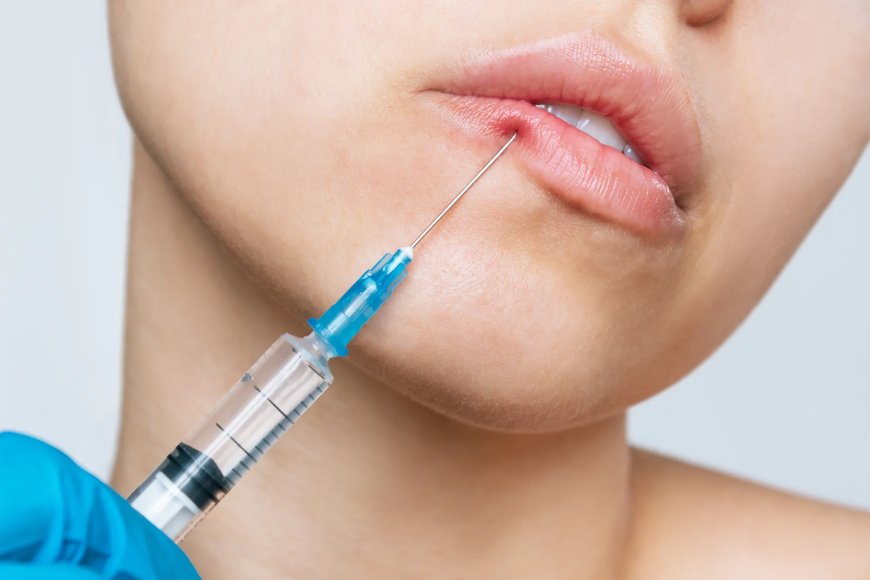 How Best Lip Fillers Injections Give You a Soft Glamorous Look