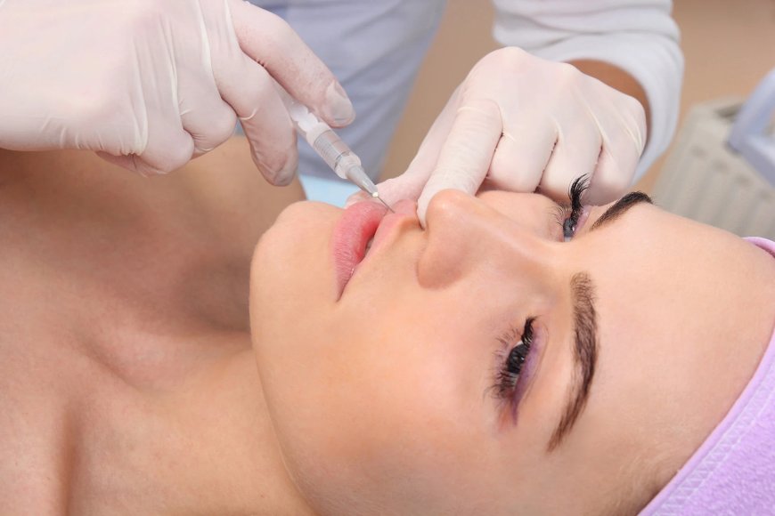 Best Lip Fillers Injections That Give You a Youthful Look Fast
